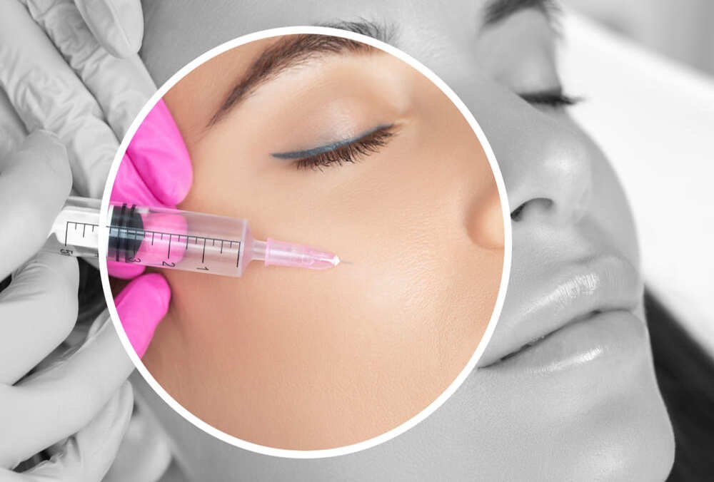 Aumento de Pómulos con ácido hialurónico en Madrid