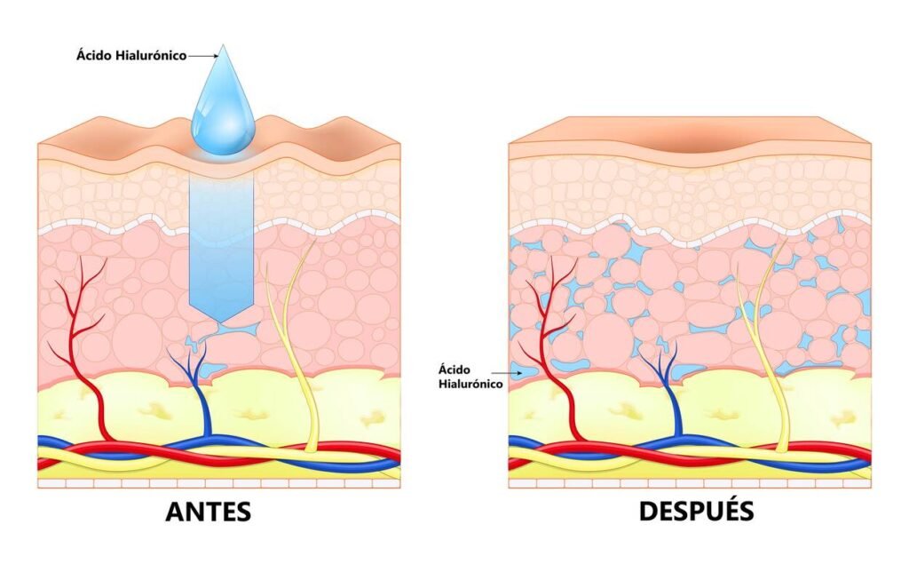 Beneficios del Ácido Hialurónico