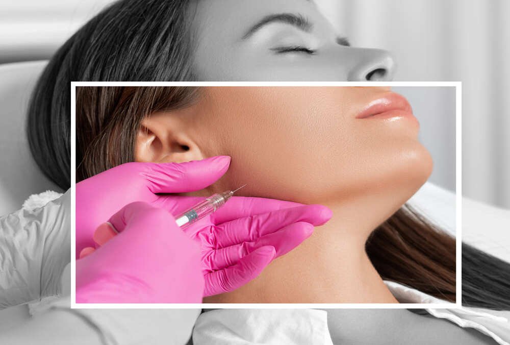 Definición mandibular con ácido hialurónico en Madrid