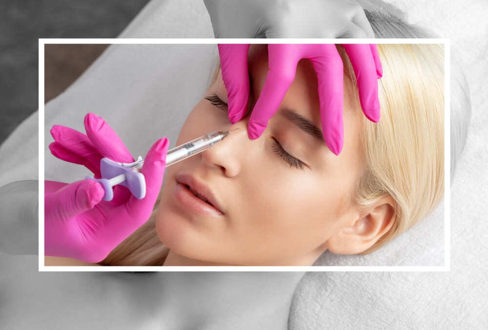 Rinomodelación con ácido hialurónico sin cirugía en Madrid